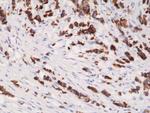 Cytokeratin 19 Antibody in Immunohistochemistry (Paraffin) (IHC (P))