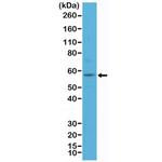 Cytokeratin 4 Antibody in Western Blot (WB)