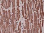 Desmin Antibody in Immunohistochemistry (Paraffin) (IHC (P))