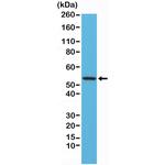 Desmin Antibody in Western Blot (WB)