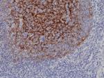 CD21 Antibody in Immunohistochemistry (Paraffin) (IHC (P))