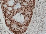 MSH2 Antibody in Immunohistochemistry (Paraffin) (IHC (P))