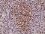 PAX5 Antibody in Immunohistochemistry (Paraffin) (IHC (P))