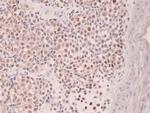 IRF4 Antibody in Immunohistochemistry (Paraffin) (IHC (P))