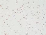 SATB2 Antibody in Immunohistochemistry (Paraffin) (IHC (P))