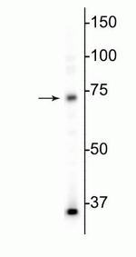 MECP2 Antibody in Western Blot (WB)