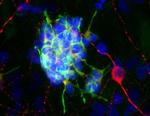 Doublecortin Antibody in Immunocytochemistry (ICC/IF)