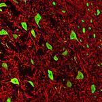 NeuN Antibody in Immunohistochemistry (IHC)