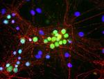 RBFOX1 Antibody in Immunocytochemistry (ICC/IF)