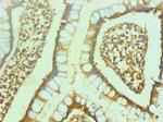 NSE Antibody in Immunohistochemistry (Paraffin) (IHC (P))