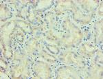 PLA2G7 Antibody in Immunohistochemistry (Paraffin) (IHC (P))