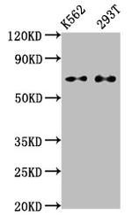 ATF2 Antibody in Western Blot (WB)