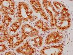 ATF4 Antibody in Immunohistochemistry (Paraffin) (IHC (P))