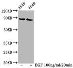 Phospho-B-Raf (Thr401) Antibody in Western Blot (WB)