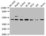 CCR9 Antibody in Western Blot (WB)