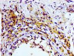 CD81 Antibody in Immunohistochemistry (Paraffin) (IHC (P))