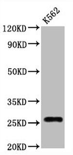 CD81 Antibody in Western Blot (WB)