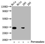 Phospho-CDK2 (Tyr15) Antibody in Western Blot (WB)