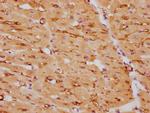 Calponin 1 Antibody in Immunohistochemistry (Paraffin) (IHC (P))