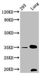 Calponin 1 Antibody in Western Blot (WB)