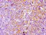 CD21 Antibody in Immunohistochemistry (Paraffin) (IHC (P))