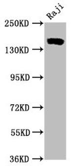 CD21 Antibody in Western Blot (WB)