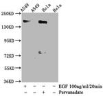 Phospho-EGFR (Tyr1092) Antibody in Western Blot (WB)