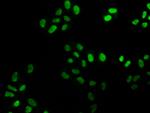 FEN1 Antibody in Immunocytochemistry (ICC/IF)