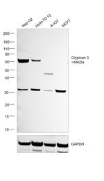 Glypican 3 Antibody in Western Blot (WB)