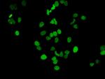 H3K14ac Antibody in Immunocytochemistry (ICC/IF)