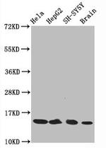 H3K14ac Antibody in Western Blot (WB)