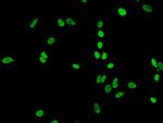 H4K5ac Antibody in Immunocytochemistry (ICC/IF)