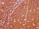 Phospho-LAT (Tyr191) Antibody in Immunohistochemistry (Paraffin) (IHC (P))