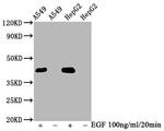 Phospho-ERK1/ERK2 (Thr185, Thr202) Antibody in Western Blot (WB)