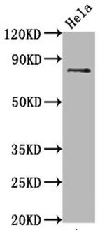 Phospho-Tau (Ser396) Antibody in Western Blot (WB)