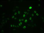 Phospho-c-Myc (Ser62) Antibody in Immunocytochemistry (ICC/IF)