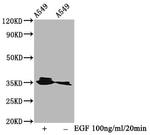 Phospho-PP2A alpha (Tyr307) Antibody in Western Blot (WB)