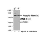 Phospho-p70 S6 Kinase (Thr421, Ser424) Antibody in Western Blot (WB)