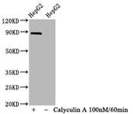 Phospho-STAT1 (Ser727) Antibody in Western Blot (WB)