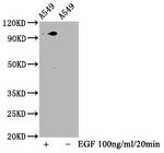 Phospho-STAT3 (Ser727) Antibody in Western Blot (WB)