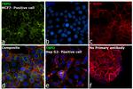 TSPO Antibody in Immunocytochemistry (ICC/IF)