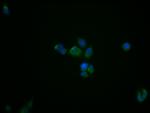 TSPO Antibody in Immunocytochemistry (ICC/IF)