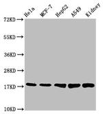 TSPO Antibody in Western Blot (WB)