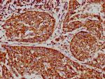 VDAC Antibody in Immunohistochemistry (Paraffin) (IHC (P))