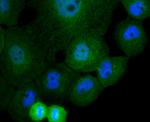 Cullin 4A Antibody in Immunocytochemistry (ICC/IF)