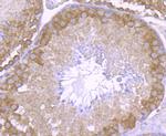 NCK1 Antibody in Immunohistochemistry (Paraffin) (IHC (P))