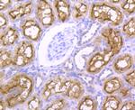 NCK1 Antibody in Immunohistochemistry (Paraffin) (IHC (P))