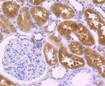 Villin Antibody in Immunohistochemistry (Paraffin) (IHC (P))