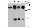 Villin Antibody in Western Blot (WB)