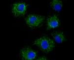 TYRP1 Antibody in Immunocytochemistry (ICC/IF)